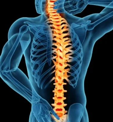 تنگی کانال نخاع چیست و چگونه درمان می شود؟